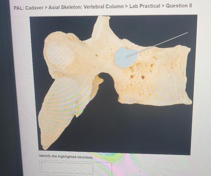 Pal cadaver axial skeleton skull lab practical question 25