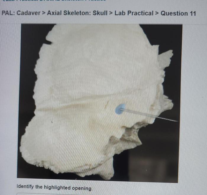 Pal cadaver axial skeleton skull lab practical question 25