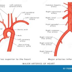 Label the arteries emerging from the abdominal aorta